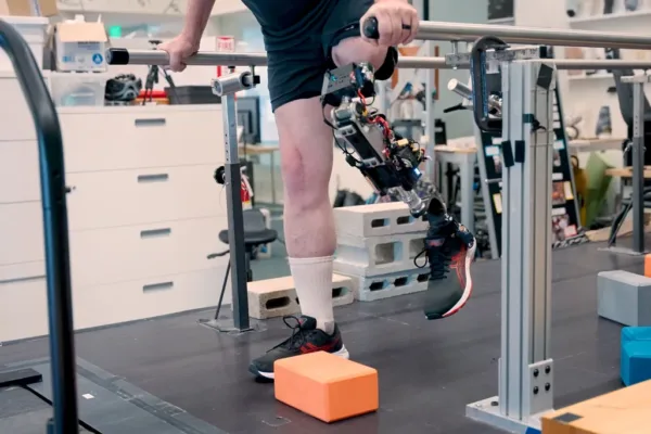 Man standing on treadmill with bionic leg