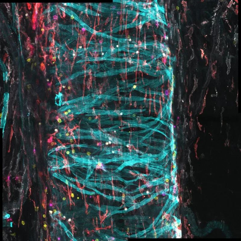 microscopy image of meningeal sinuses of a mouse stained in one color, with some of the immune cells stained in three other colors