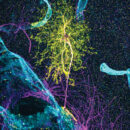 colorful image of astrocyte brain cell
